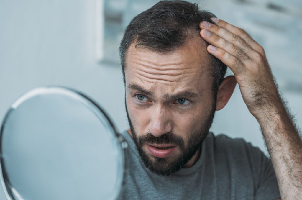 Pourquoi je perds mes cheveux Comment prévenir et traiter la perte de