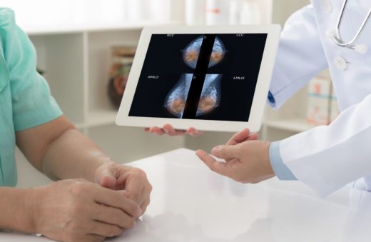 Mammographie Anormale Medecin