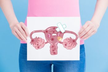 Fibrome Uterus Operation