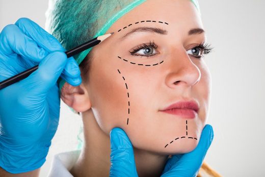 Lignes de Perforation de dessin chirurgien sur le visage de la femme